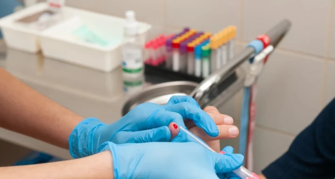 Czy przed badaniem krwi można palić? Sprawdź, jak to wpływa na wyniki