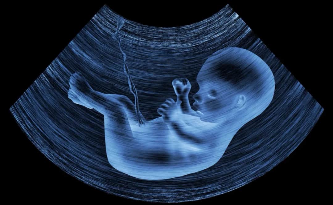 Czy zespół Downa można wykryć na USG? Kluczowe informacje i objawy