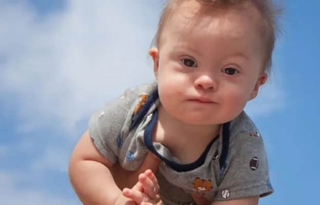 Jak wytłumaczyć dziecku zespół Downa w prosty i empatyczny sposób