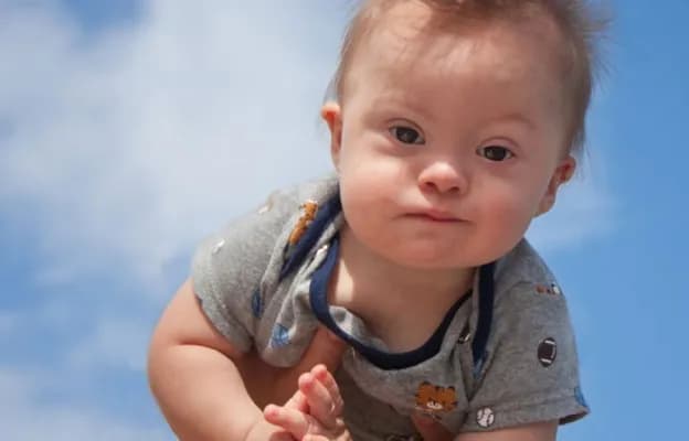 Jak wytłumaczyć dziecku zespół Downa w prosty i empatyczny sposób