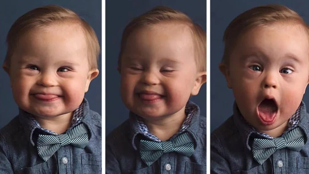 Jak adoptować dziecko z zespołem Downa - krok po kroku do szczęścia