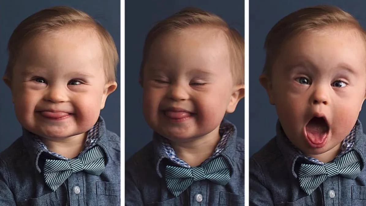 Jak adoptować dziecko z zespołem Downa - krok po kroku do szczęścia