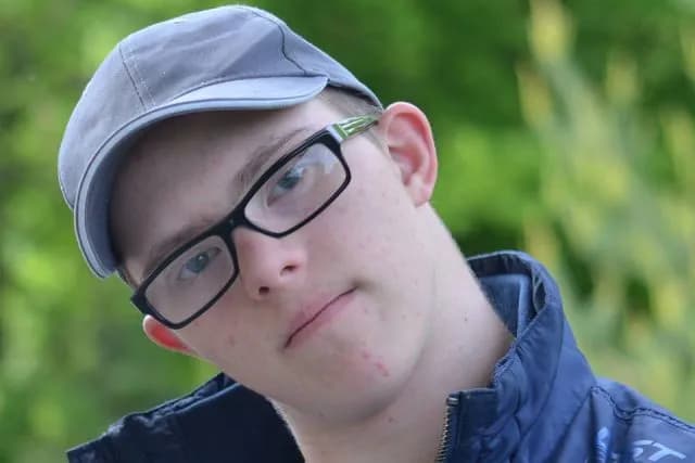 Zewnętrzne objawy zespołu Downa – jak je rozpoznać i zrozumieć