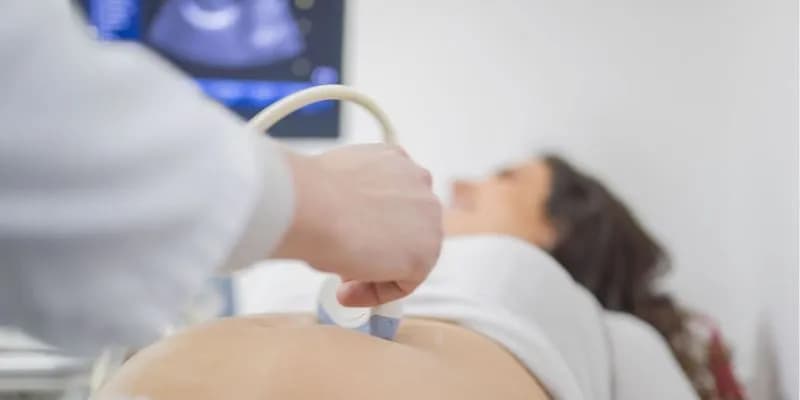 Czy zespół Downa jest widoczny na USG? Odkryj ważne wskaźniki