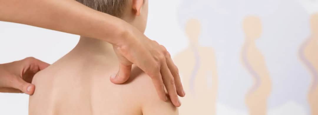 Ile trwa rehabilitacja skoliozy? Poznaj kluczowe czynniki wpływające na czas terapii Ile trwa rehabilitacja skoliozy? Poznaj kluczowe czynniki wpływające na czas terapii