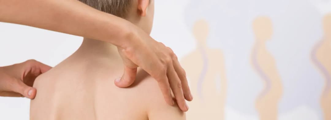 Ile trwa rehabilitacja skoliozy? Poznaj kluczowe czynniki wpływające na czas terapii