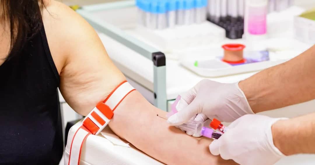 Co jeść przed badaniem glukozy, aby uniknąć błędnych wyników?