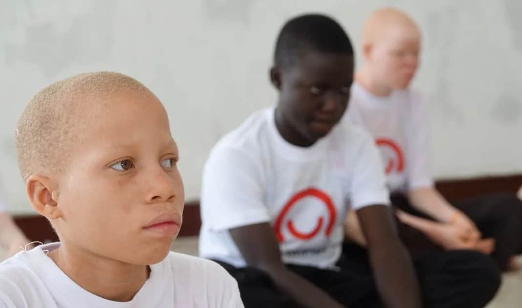 Co to jest upośledzenie? Zrozumienie skutków i przyczyn tej niepełnosprawności